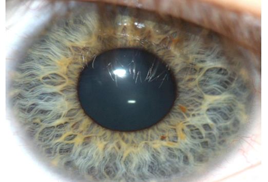 fig1