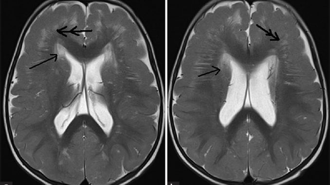 JClinImagingSci_2016_6_1_15_181491_u2